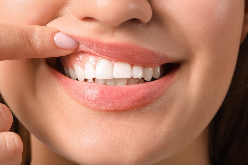 Young,Woman,With,Healthy,Gums,,Closeup