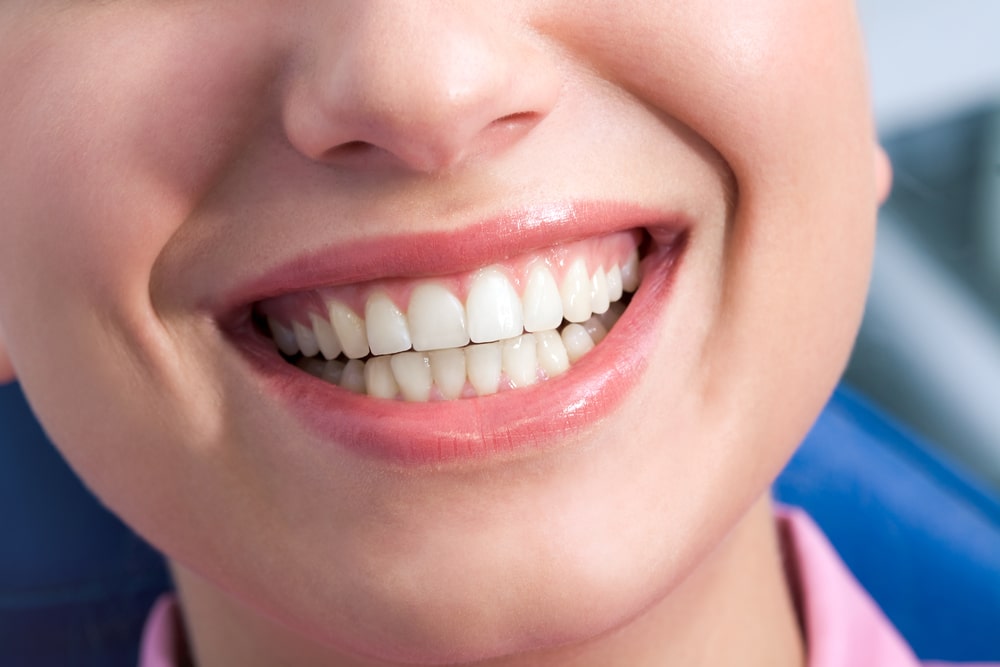 Woman with pretty smile has visible gums around her teeth.